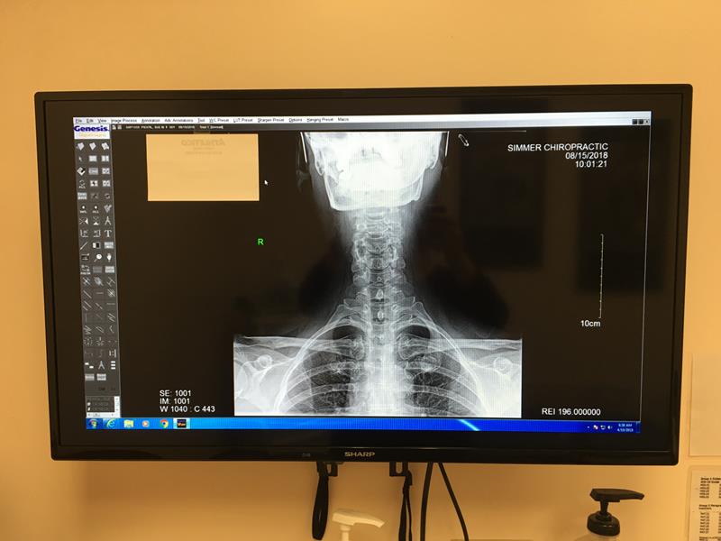 Chiropractic Digital X Ray Services Simmer Chiropractic